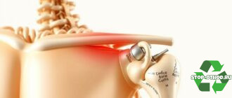 Вывих плечевого сустава: что это такое, как понять и как не усугубить ситуацию